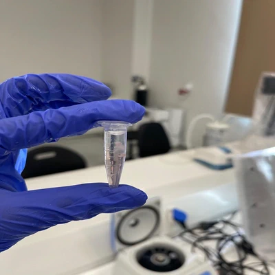 Hands-on DNA extraction from strawberry by my students using lab-prepared reagents.