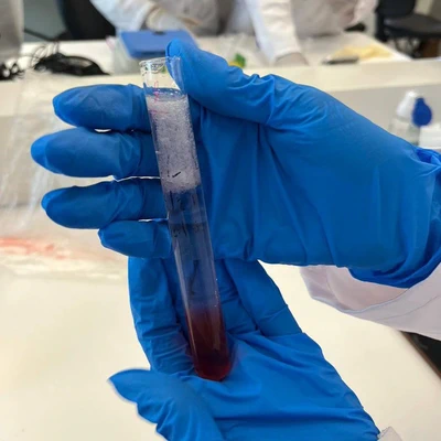 Hands-on DNA extraction from strawberry by my students using lab-prepared reagents.