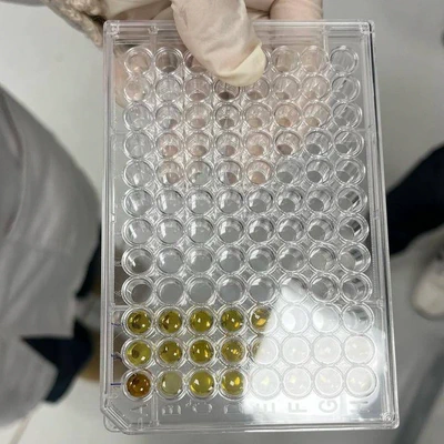 My students having hands-on experience with ELISA.