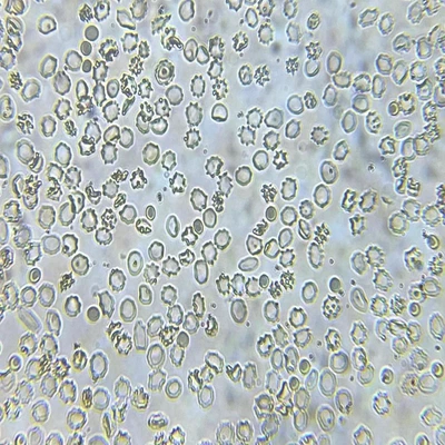Effect of hypertonic solution on the morphology of RBCs.