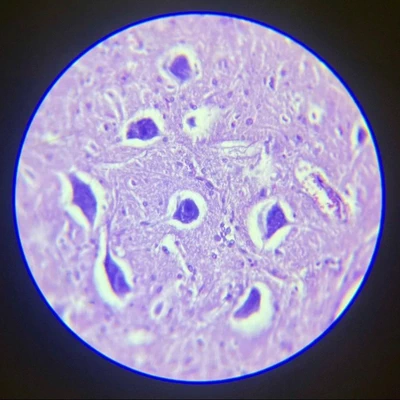 Micrograph illustrating neuronal bodies and neuroglia in lumbar spinal cord.