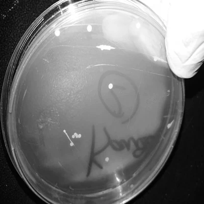 Successful transformation of <i>E. coli</i> with a kanamycin-resistant plasmid.